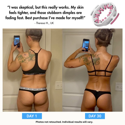 Veyora™ - MyoGlide Pro